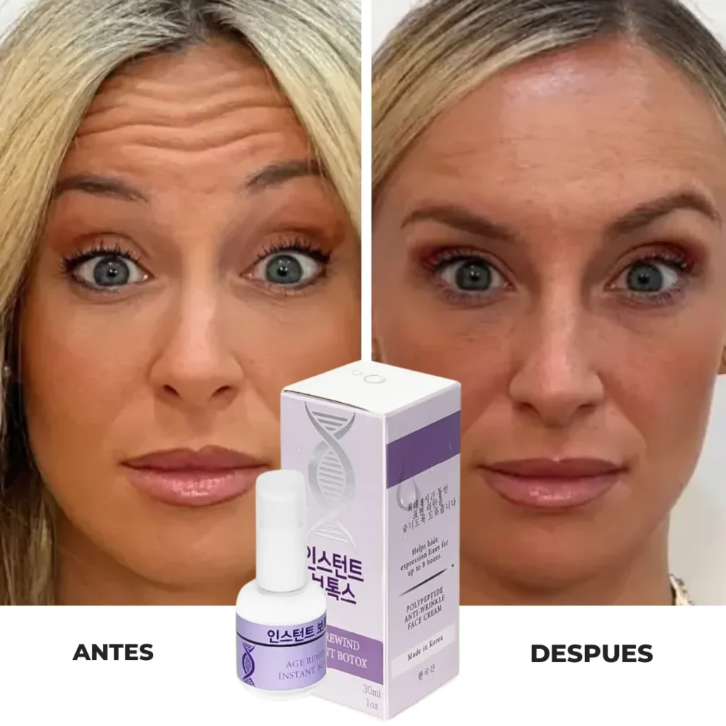 covkifixnobfo8bp2a0y