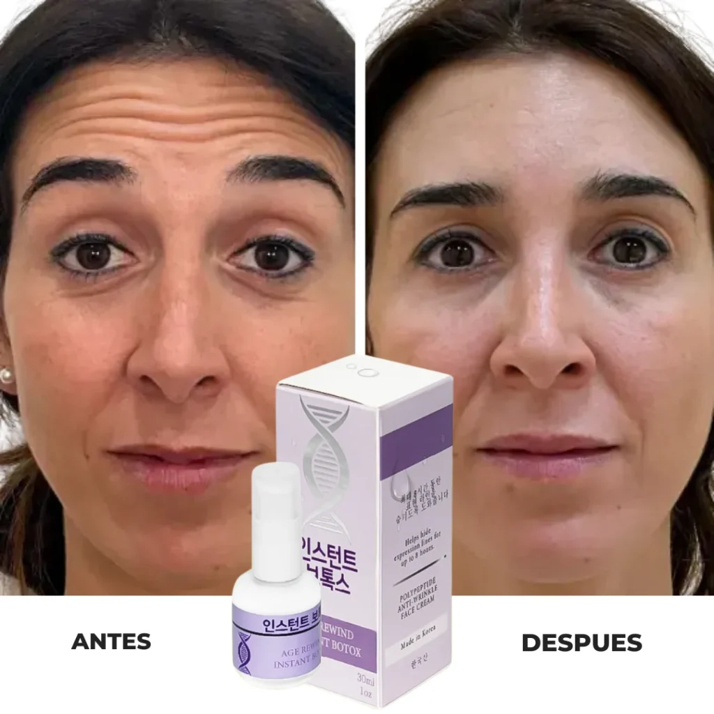 fxxathvaea6ppm4ostwu