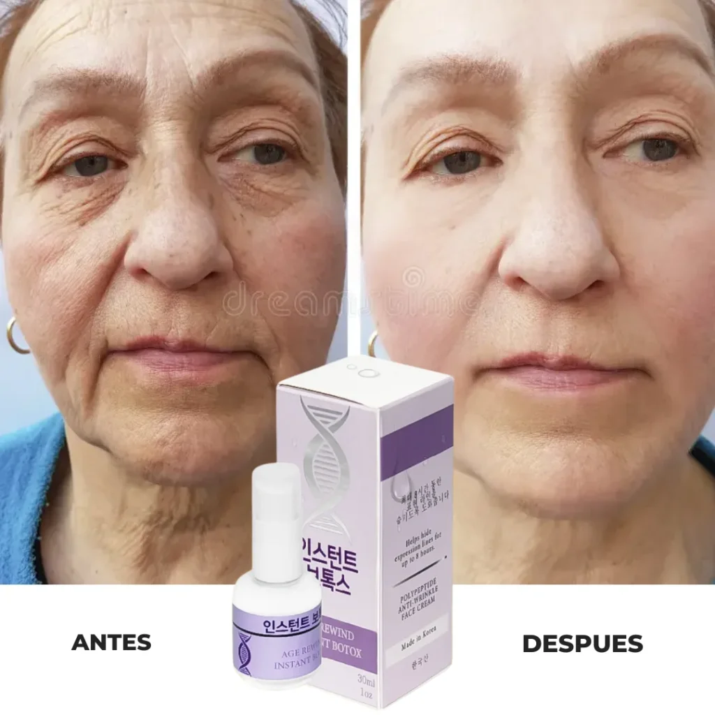 myvstvubwdkif5xvt0u6